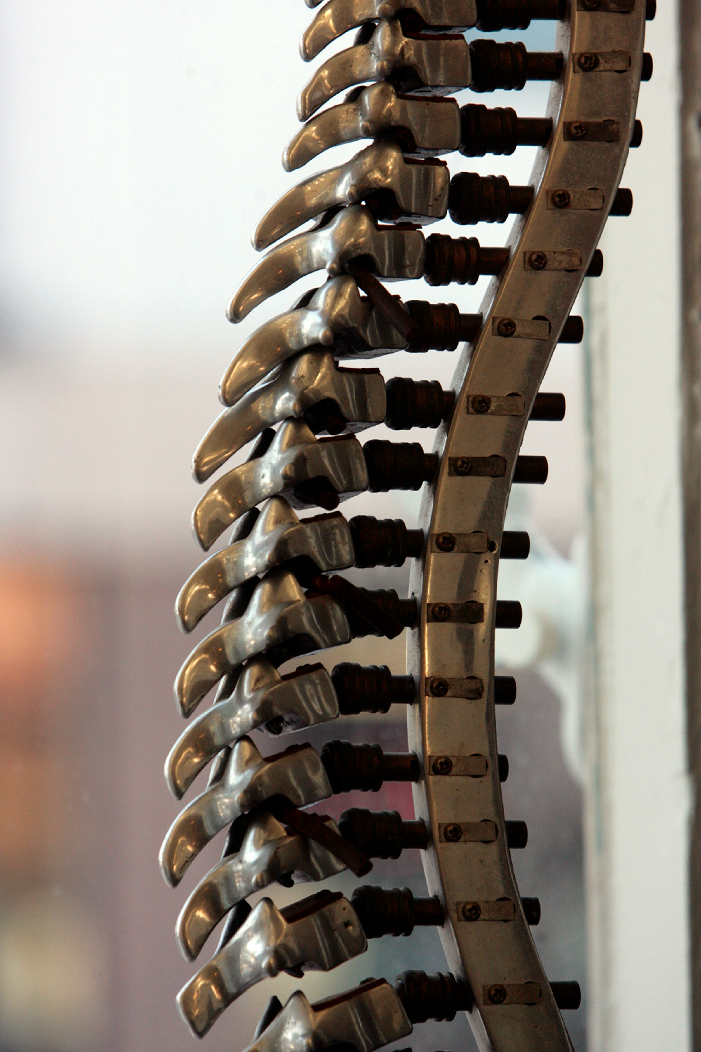 Spinal Decompression at Lockhart Chiropractic Kenosha